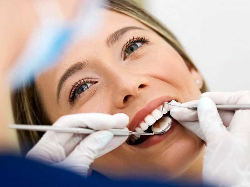 bonding zuba kako bi se poboljšao vaš osmijeh